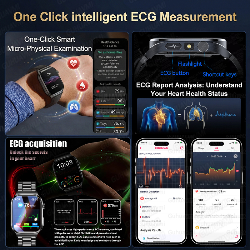 2026 New Accurate Diagnosis Sm - Smartwatch Health Watches For Women 评论和价格